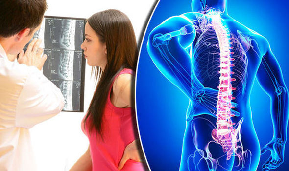 Chụp x quang lưng có phải cởi quần áo không?